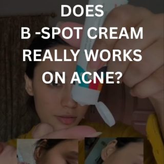 Tried everything for acne? Time to try what really works — B-SPOT.Shop your products now
www.broadaesthetic.com#skincaredaily #fyp #reels #acnetreatment #broadaesthetic #foryou #viral #explorepage #clearskin #glassskin #AcneProneSkin #acnescar